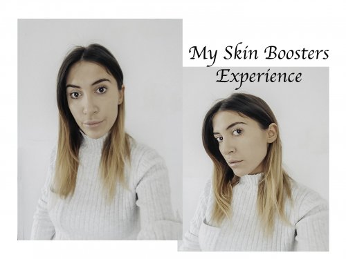 My Restylane Skin Boosters Experience